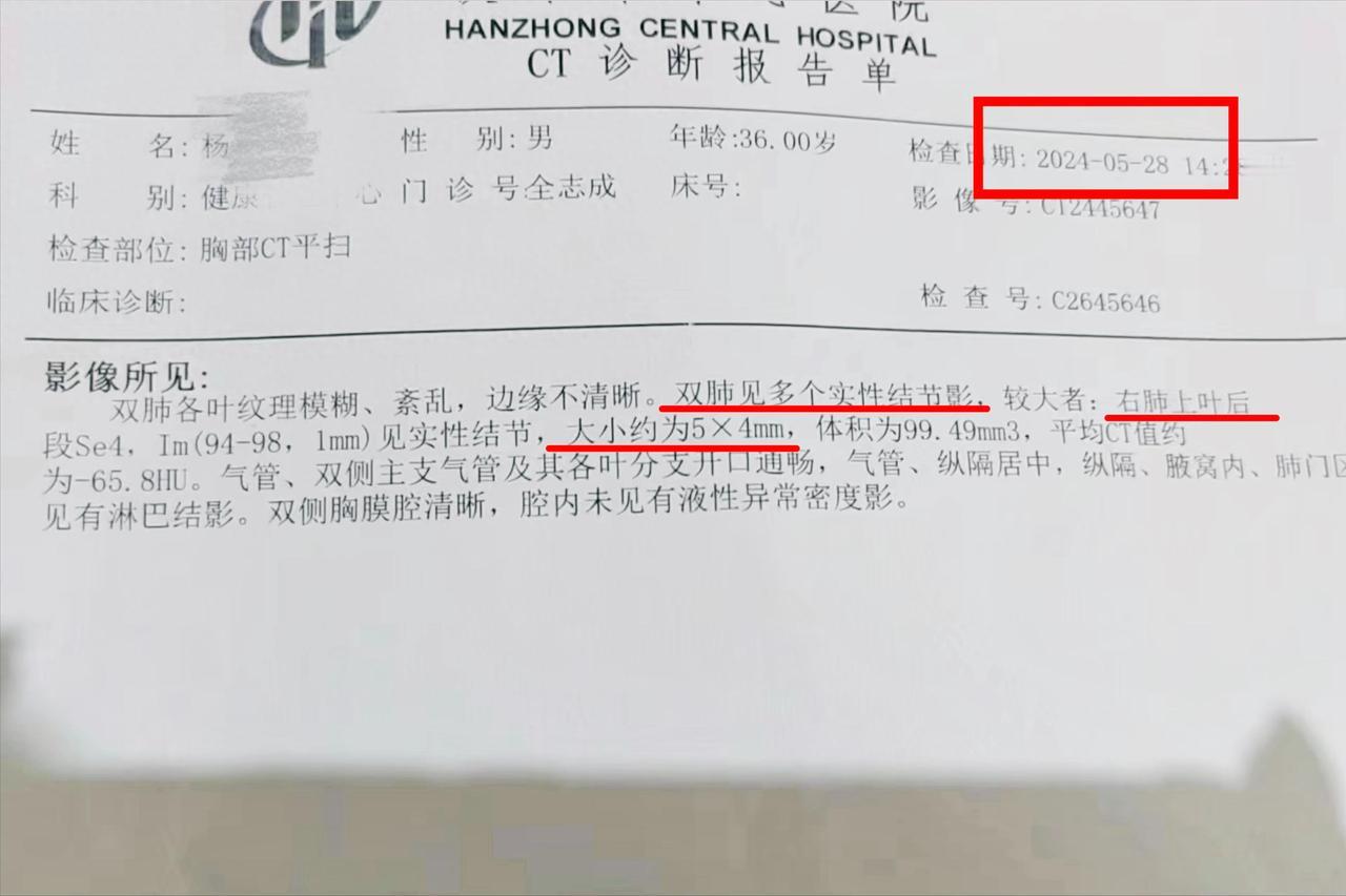 肺结节，是良性还是恶性？肺CT报告上写的很清楚，看这7点就够了拿到一张肺部C