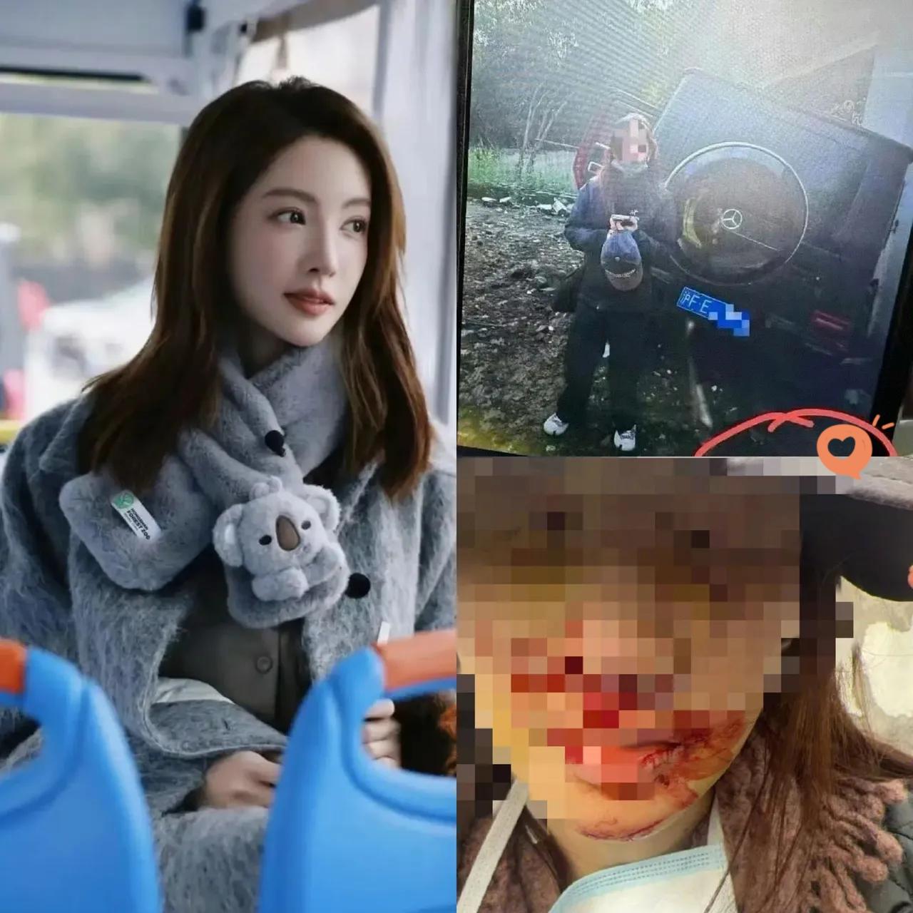 终于搞明白了金晨为啥当时出事了要逃跑不是喝醉了，也不是吸du了，而是因为她当