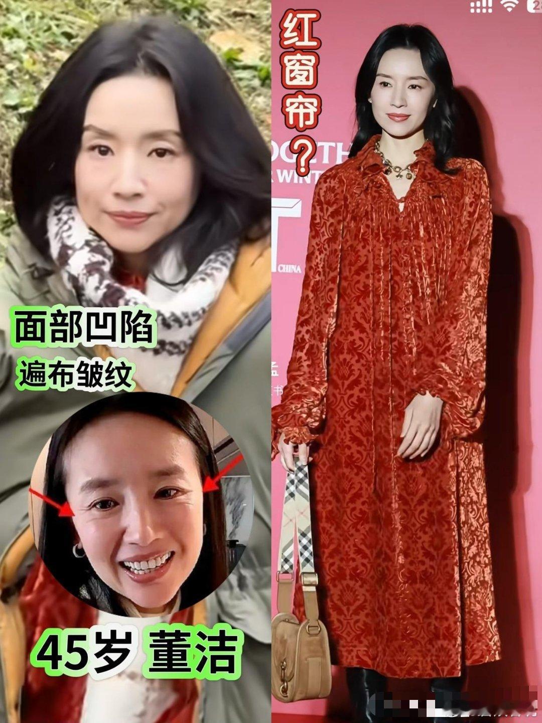 45岁董洁瘦得都没啥精气神了，现在好显老啊！面部凹陷看着人跟干枯了一样…真是上了