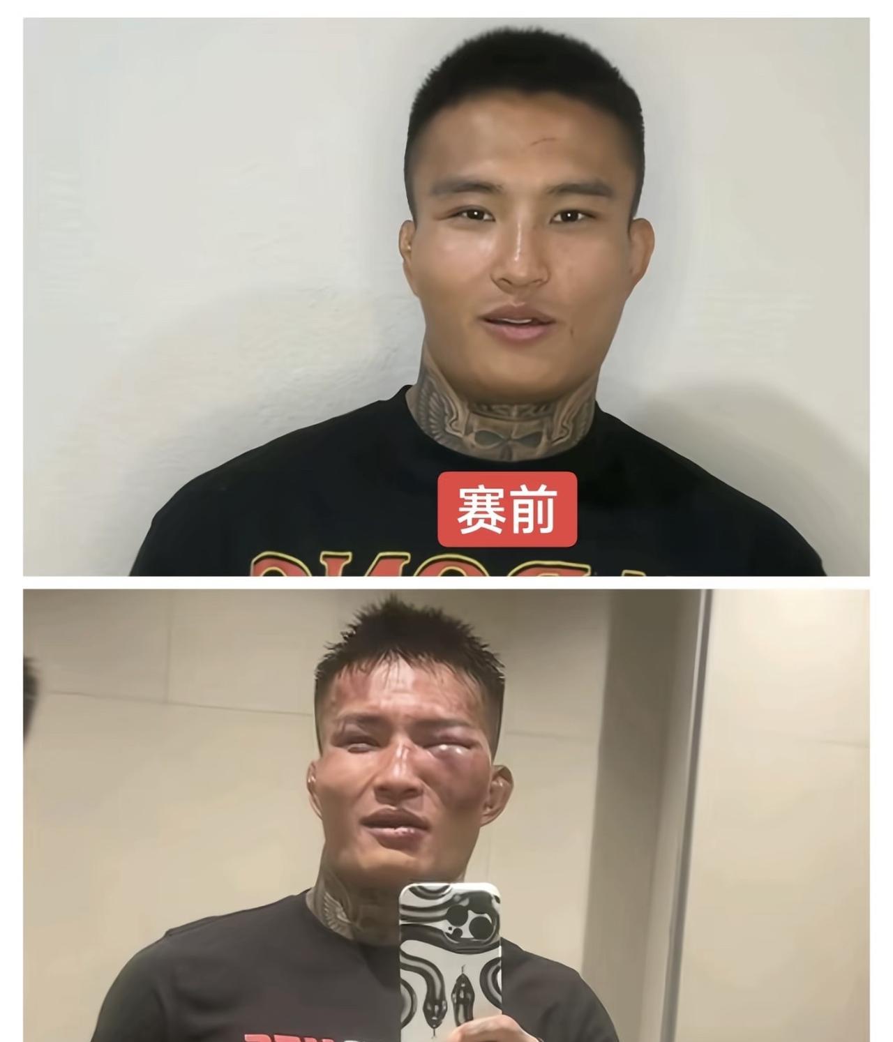 李凯文台下既能唱，台上又能打，果然是精英中的精英。这一次对战中村京一郎，只不过技