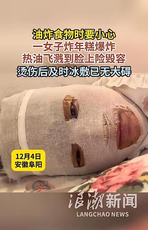 悲剧还是发生了！家人们谁懂啊！就因为嘴馋一口炸年糕，安徽阜阳这位大姐直接遭
