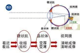孩子近视能恢复吗? 眼康世家带你揭秘青少年近视原因!