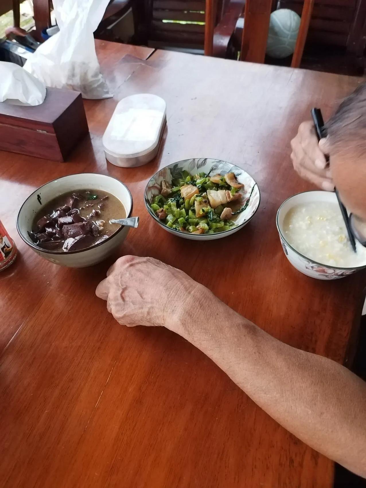 我特地请假从深圳回来容县，本来打算照顾做完阑尾炎手术的老爹，谁知道根本就不用我照