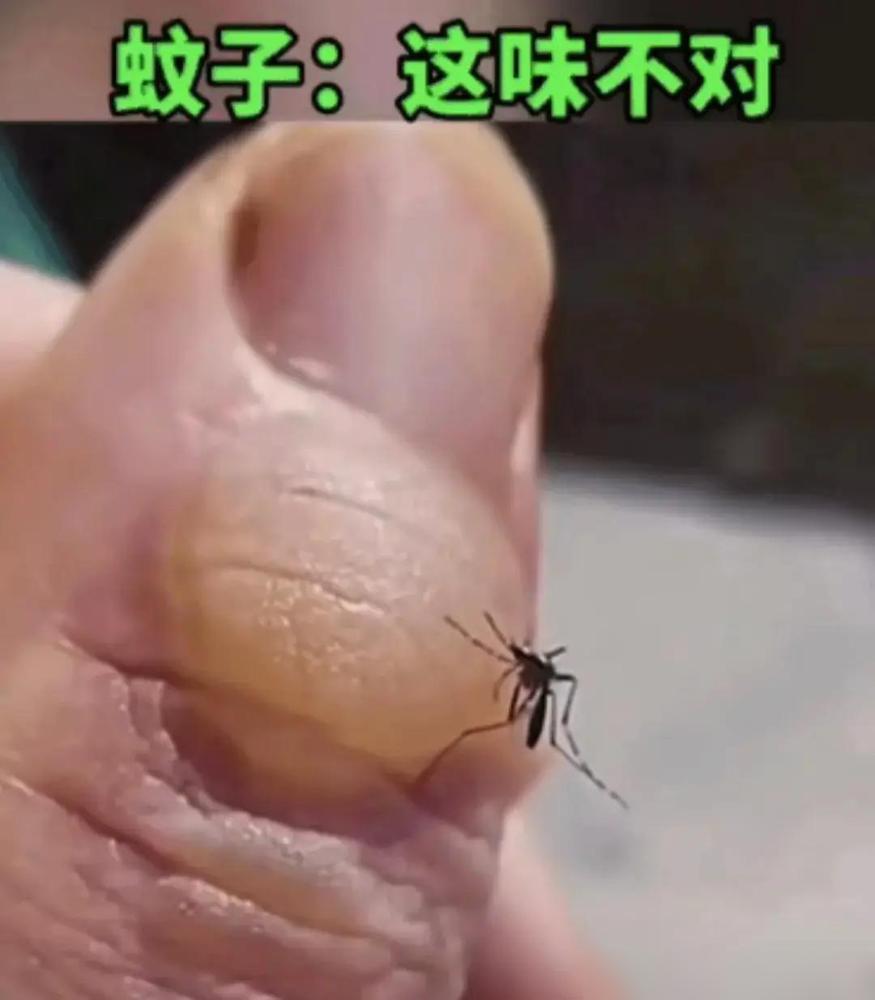 手指上不知道咋弄的，起了一大水泡，亮晶晶的。之前我手上磨出泡总忍不住要捏破，