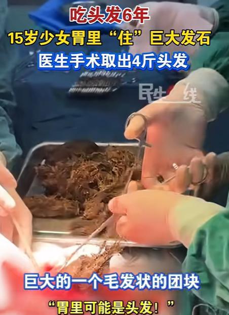 河南，一名15岁少女半年没来月经了，身高1米6，却只有35公斤！吃中药调理没效果