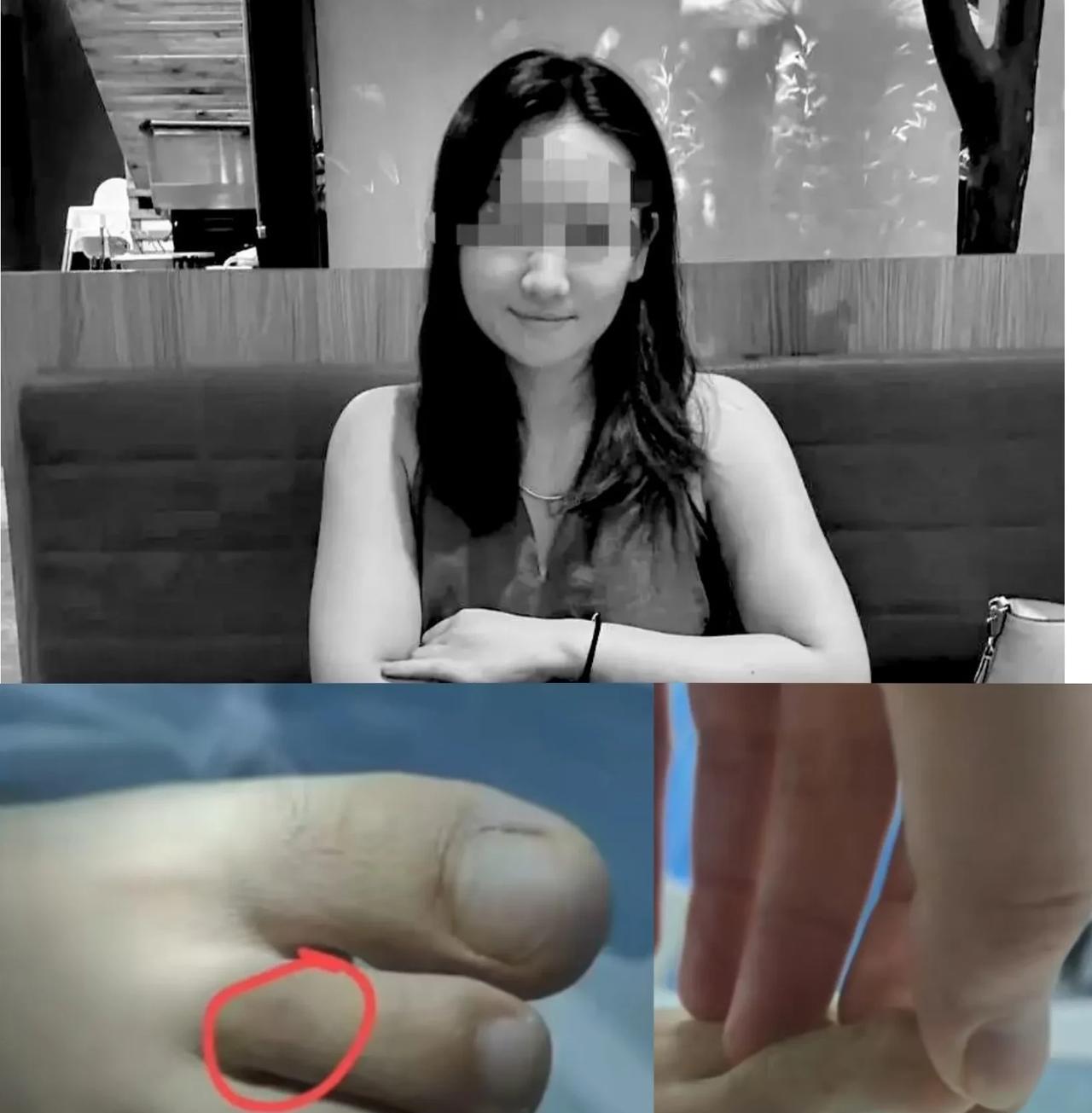 三亚被蛇咬伤致死女子事件一波三折，最新进展来了:1.原本不同意尸检的家属李先生
