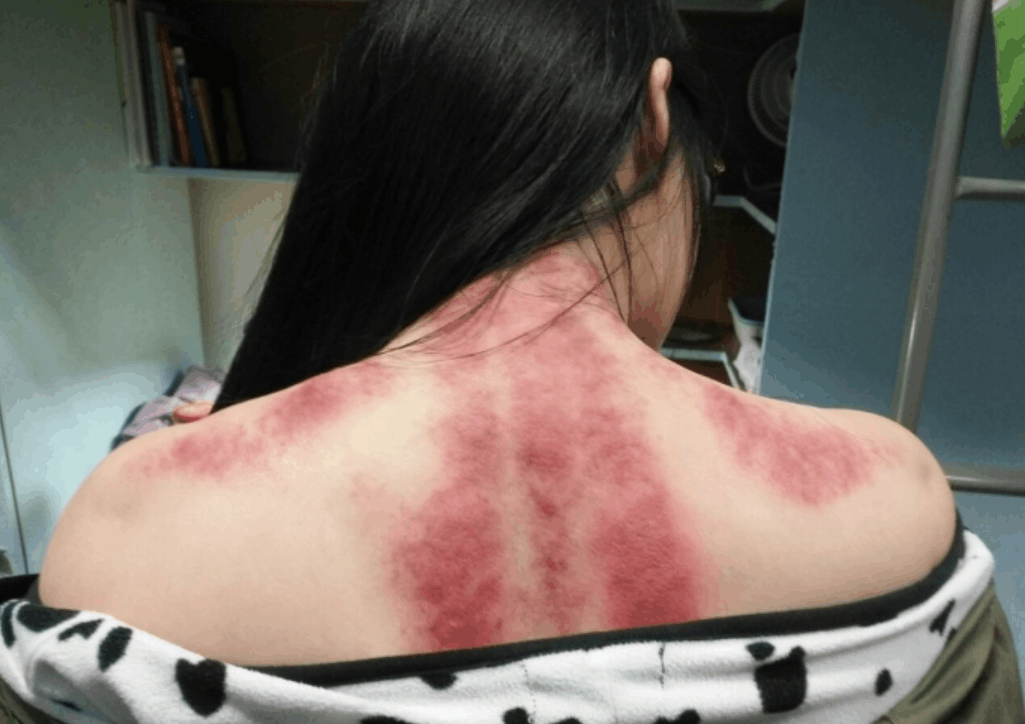 不要忽视你的肺(深度好文)