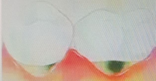 牙缝大总塞牙真的太闹心了！吃饭塞牙，不仅难受，时间长了嘴里还有异味。其实塞牙原因