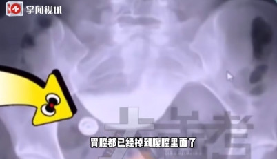 悲剧还是发生了！2025年6月，河南郑州，一女孩因为失恋和男友分手，心情非常低落