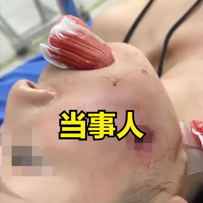 女子泰国普吉岛游玩，体验射击，结果脸被子弹打穿，舌根卡弹头，一场旅游变成了一场噩