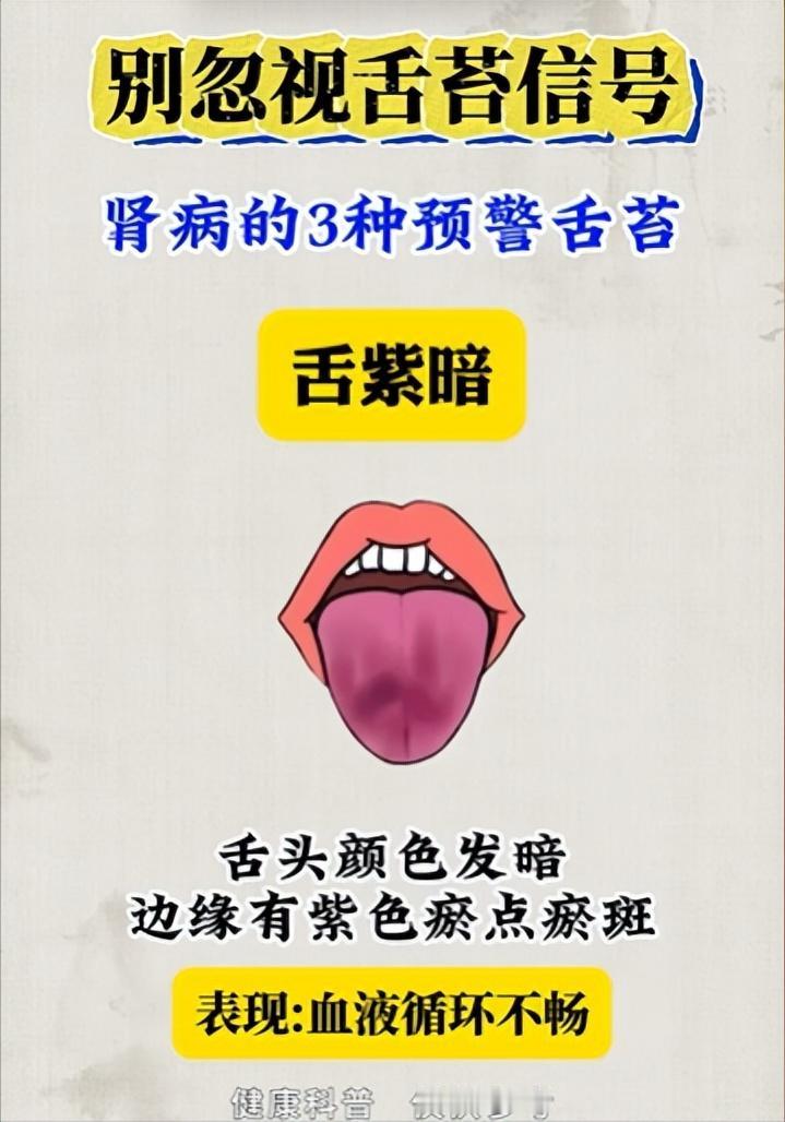 别忽视舌苔信号，肾病的3种预警舌苔~