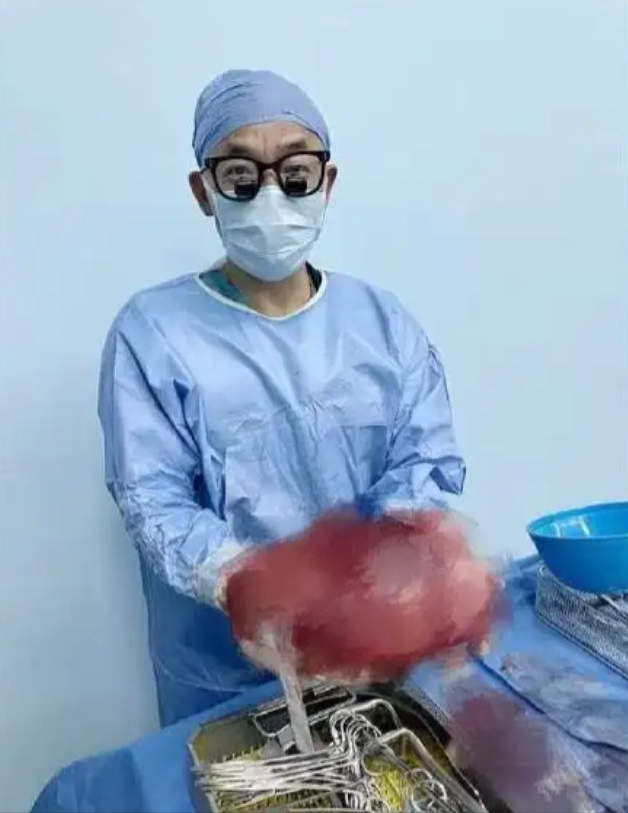 幸亏发现了！”6月，广东17岁女孩和妈妈一起逛街买衣服，在试裤子的时候，老板娘发