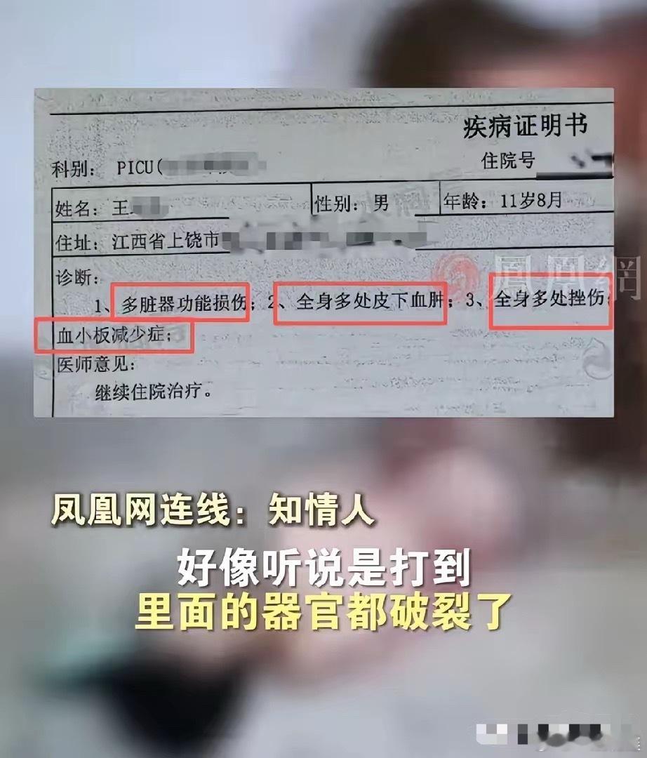 太痛心了!江西上饶被校园霸凌的孩子才11岁零8个月,因为长期被五六个同学霸凌殴打