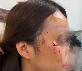 5月27日大河报报道，北京一位陈女士在家清理猫砂盆时，养了两年的虎斑母猫突然扑上