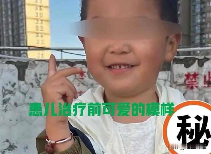 太揪心！3岁娃做牙齿根管治疗后已昏迷20多天了看到一条新闻，太揪心了！河