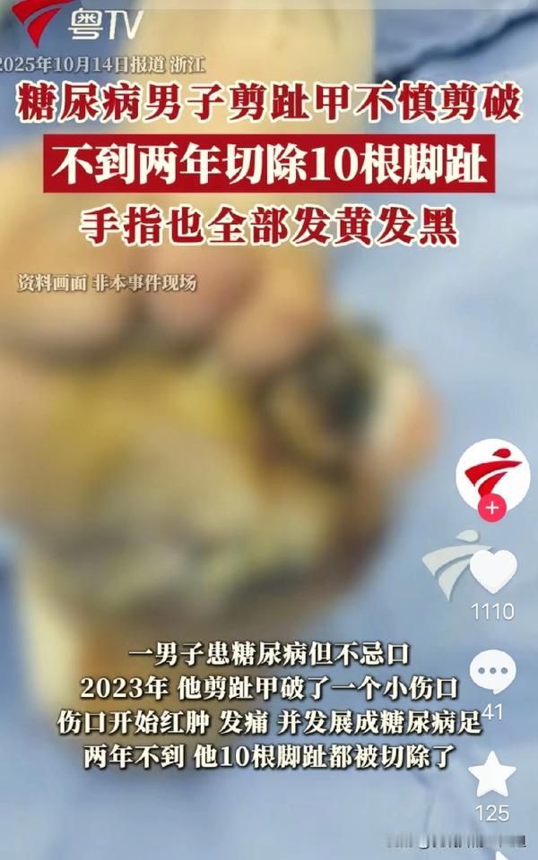 “可惜没有后悔药！”浙江一男子剪脚指甲，不慎剪破拇趾边缘，出血并不多，他贴了一张
