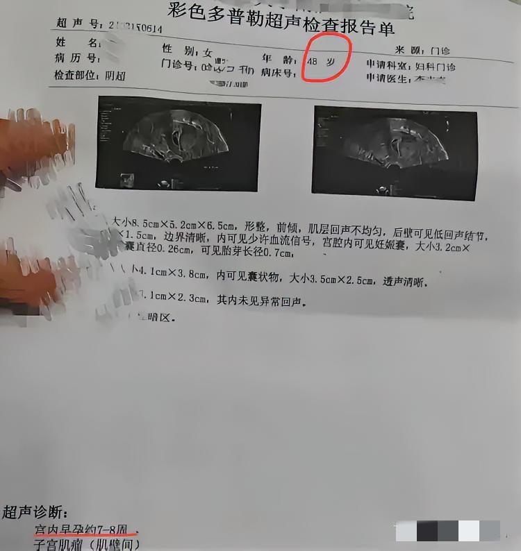 天啦噜!我一个48岁的女同事怀孕了!这同事原来只生了一个女儿(女儿今年24岁