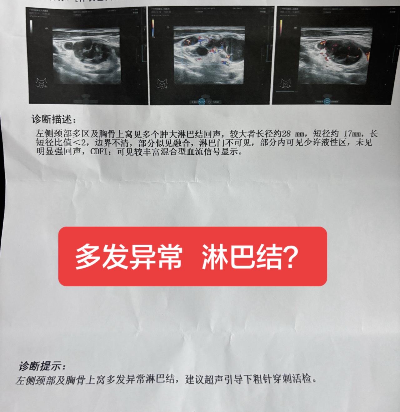 看到报告那一刻，懵了一下，医生说多发异常不是好事，那一刻我在想，我爸妈怎么办？年