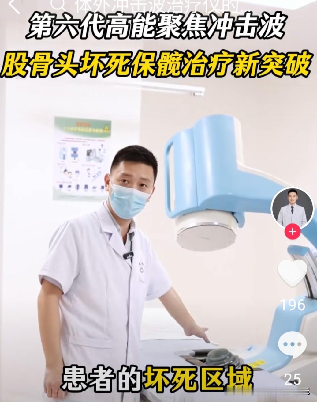 咋天去医院看病才知道，全国各大骨科医院高能聚焦式冲击波从五月中旬开始，由原来单次
