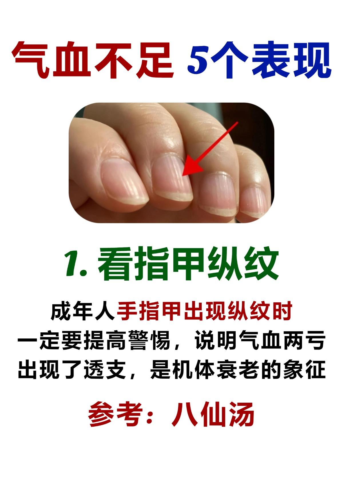 气血不足的人，看一眼就知道了！今天潘医生只用一招，精准补气血