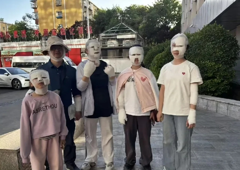 1996年贾国宇一家因卡式炉爆炸受伤获十万元赔偿，当时那可是轰动一时，铺天盖地的