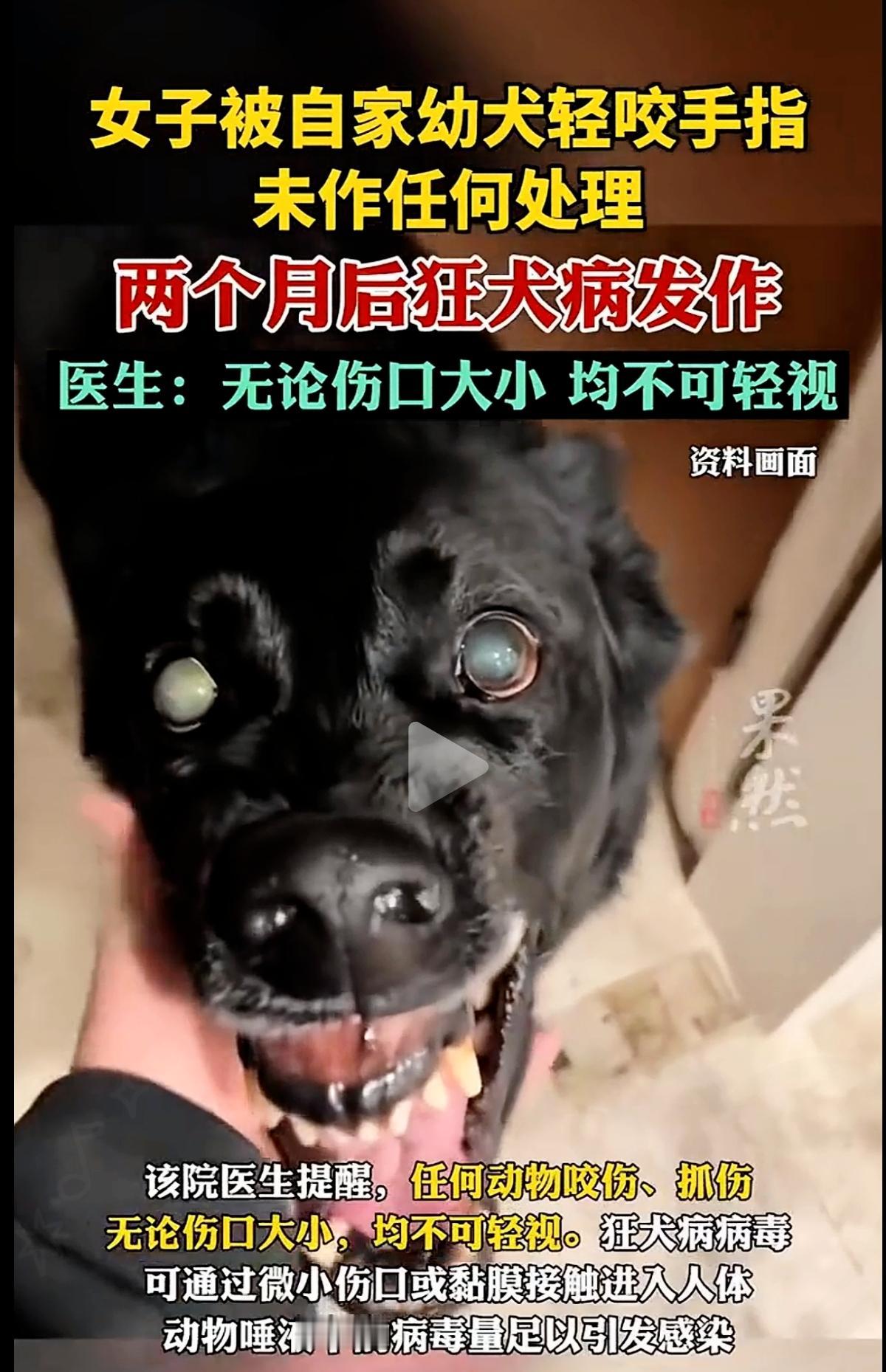 刷到女子被自家狗轻咬2个月后狂犬病发作的消息，后背瞬间冒冷汗！这哪里是小伤口，分