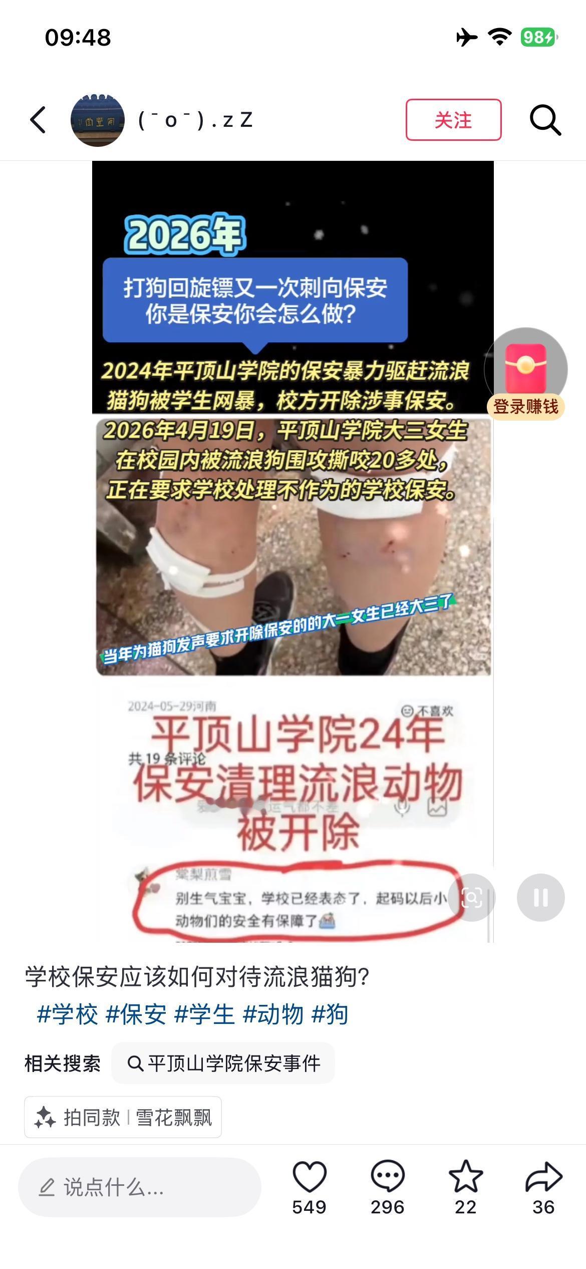 这孩子确实被咬的有点重，注意到：报道中显示的是“狗群”，说明流浪狗不少，公开信息