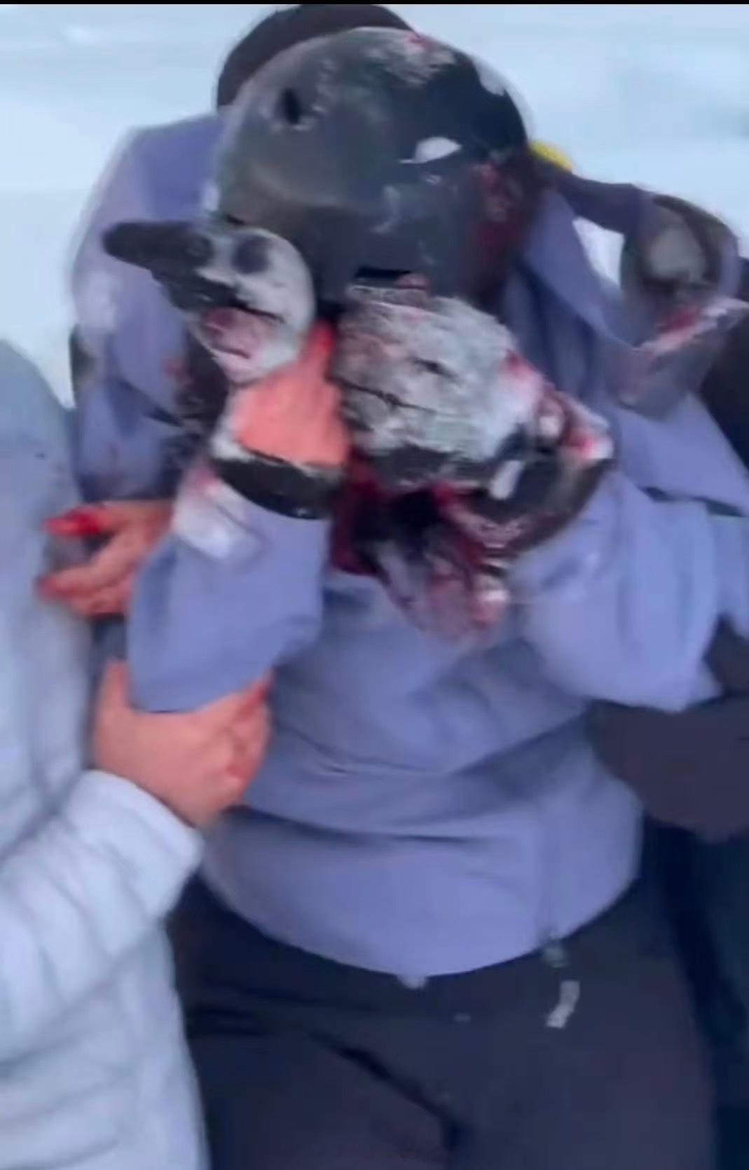 被雪豹咬伤女游客否认跟雪豹拍照有网友爆料说是雪豹饿了生扑