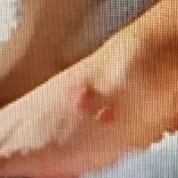 全身瘙痒且越抓越痒真的太折磨人了！这可能是皮肤干燥、过敏、感染等原因造成的。要是