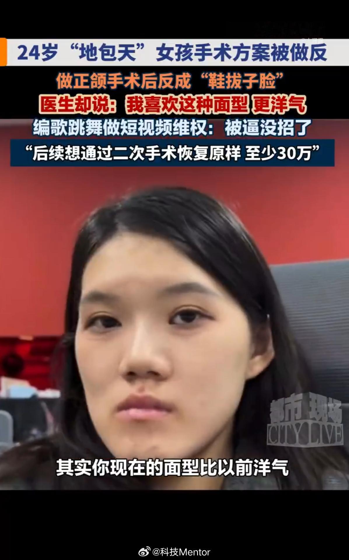 卫健委介入24岁女孩正颌手术被做反主刀医生以个人审美为由推脱，称喜欢这种面型，该