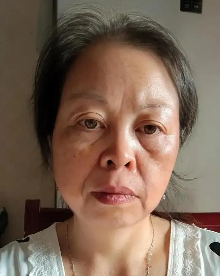 52岁突然一个月暴瘦十几斤，不用节食也不用运动，不少人第一反应竟然是偷着乐我