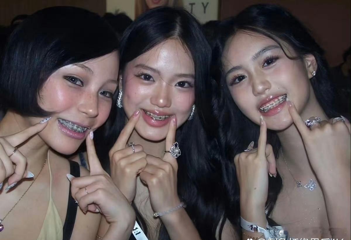 从钟丽缇女儿Jaden和考拉的牙齿矫正就能看出，富裕家庭在孩子牙齿护理上格外上心