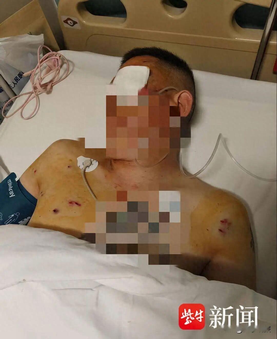 愣的怕横的，横的怕不要命的。倪先生在银行门口遭遇歹徒持自制枪支抢劫，被打瞎了一