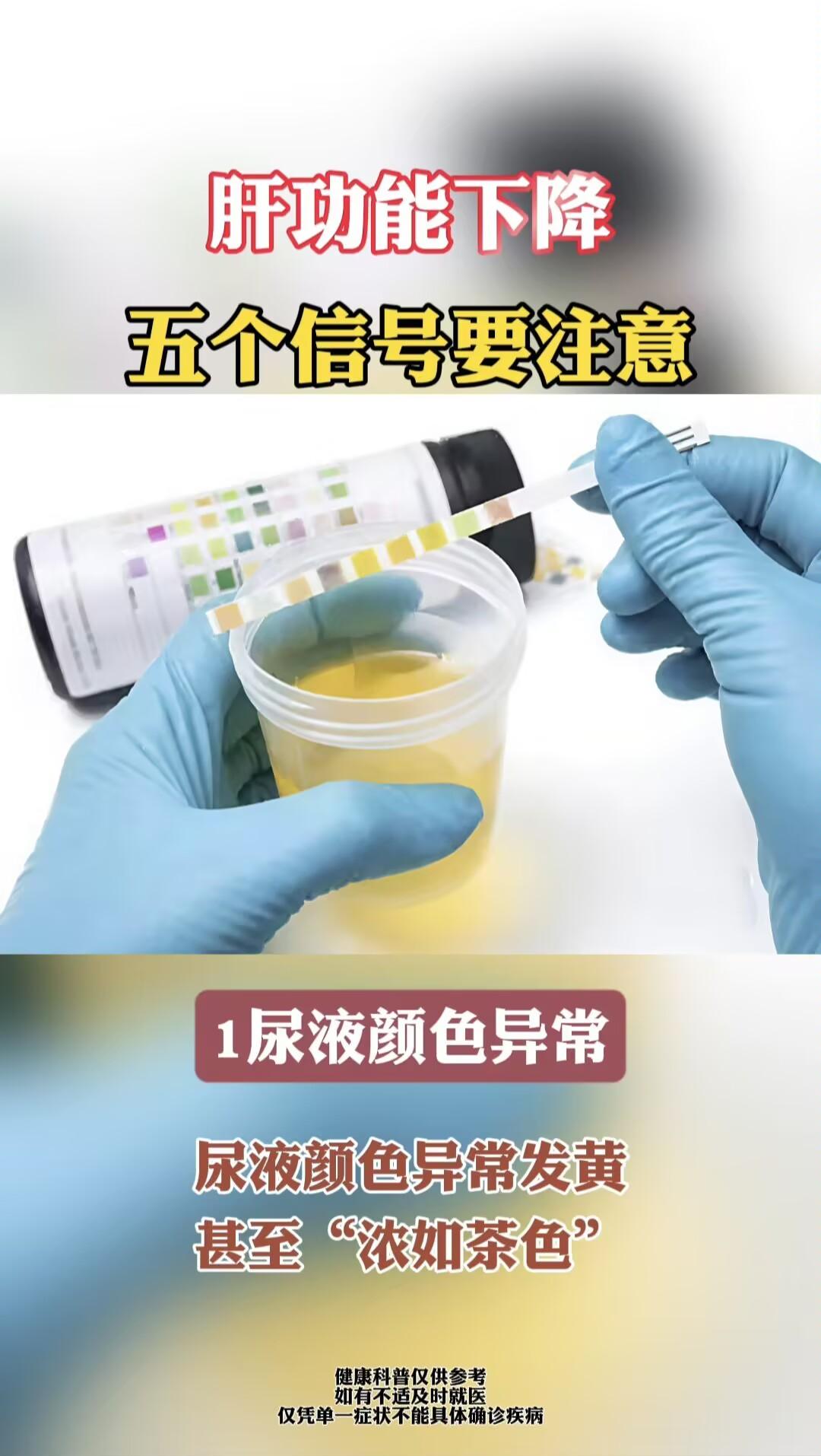 乙肝 肝病 科普