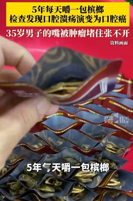 “还敢吃槟榔吗”？35岁一男子有嚼槟榔的习惯，5年里每天都嚼一包槟榔，忽然有一天