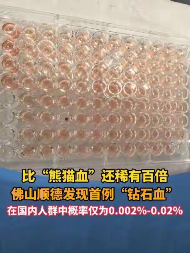 广东顺德发现一例“钻石血”，这消息太惊人了！“钻石血”即Jk(a-b-)血