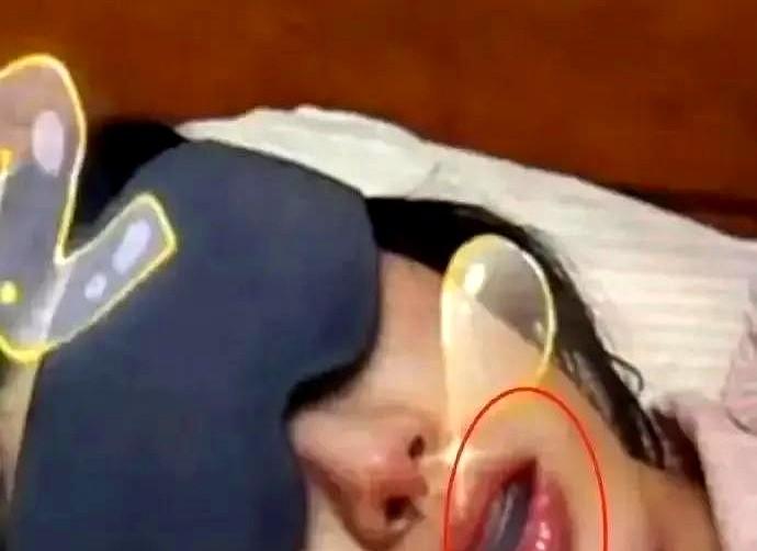 金晨在真人秀里午睡被镜头逮到戴着透明保持器，嘴角微微翘起，像条安静的小金鱼。这个