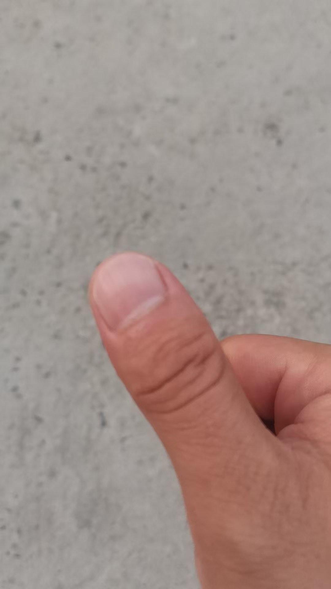 朋友去年买的理想L7，第一年就因为电吸门被夹了一次。今年女儿也被夹了一次，还去了