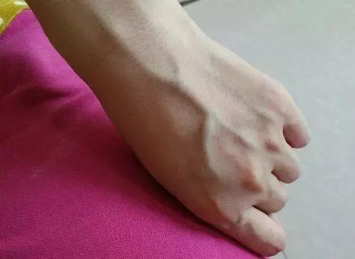 手上青筋越多, 说明身体越......尤其是女性要看