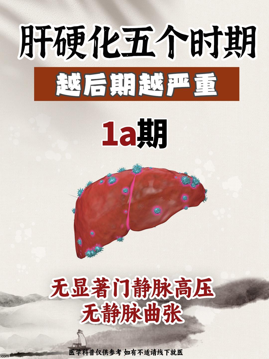 肝硬化五个时期，越后期越严重！。