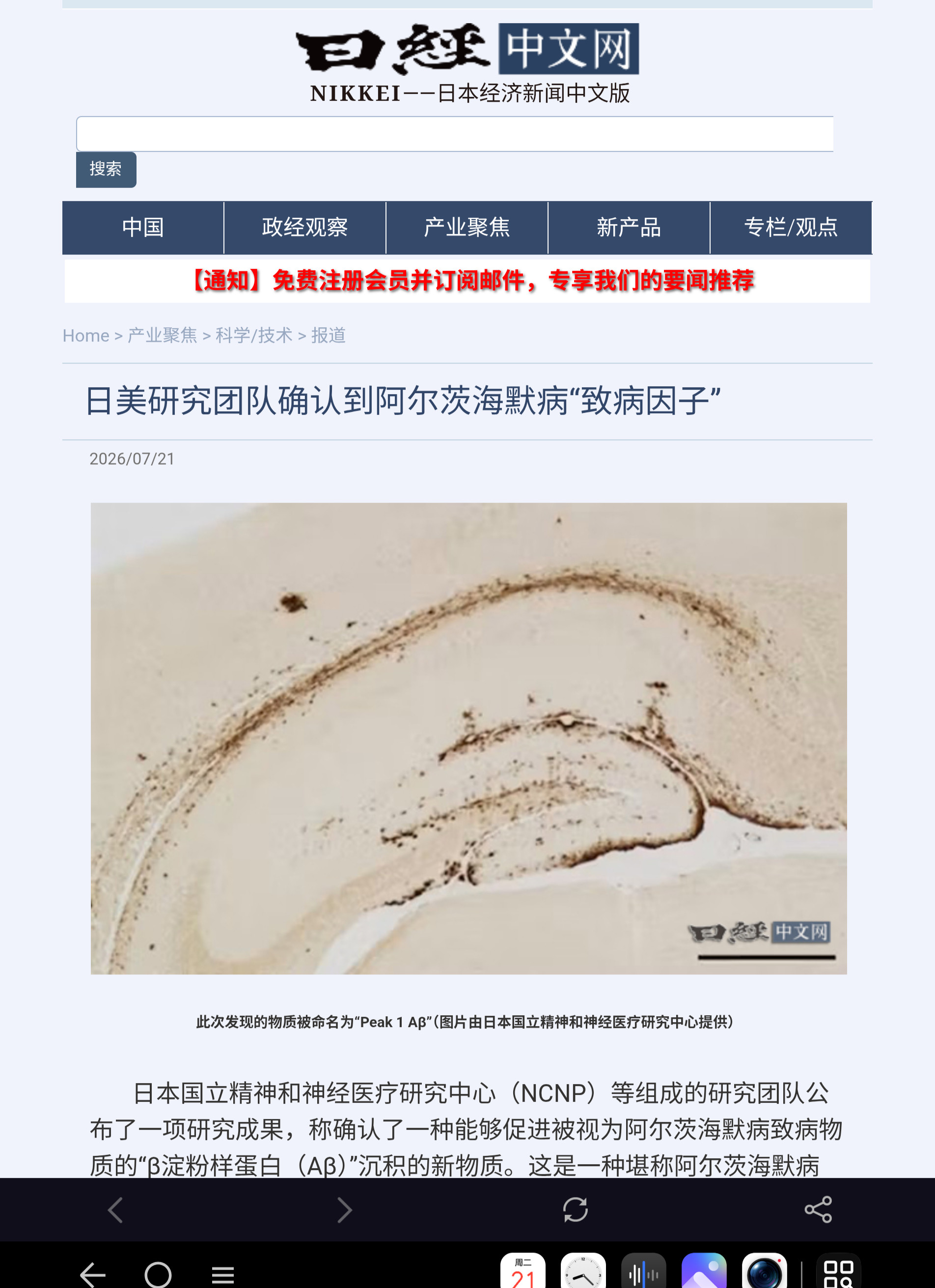 日本国立精神和神经医疗研究中心（NCNP）等组成的研究团队公布了一项研究成果，称