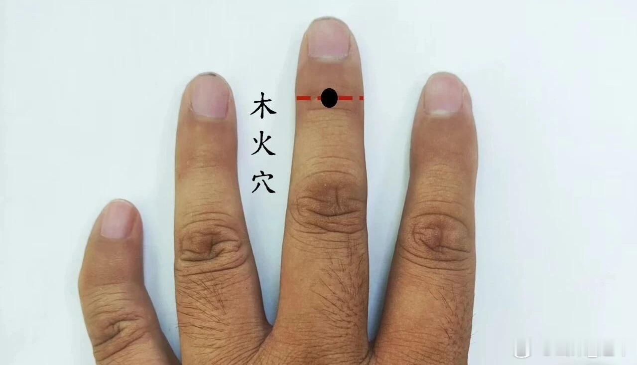 木火穴治疗半身不遂的特效穴木火穴源于董氏奇穴位置:在中指背第三节横纹中央穴性: