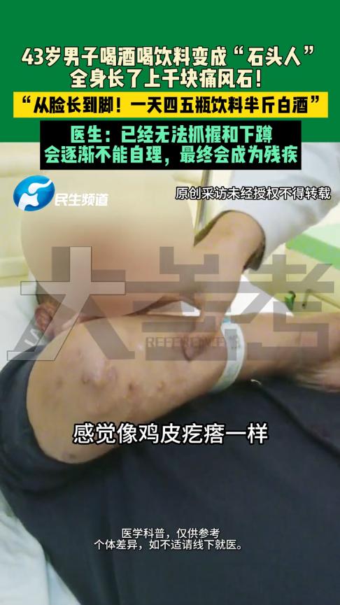 悲剧还是发生了！河南郑州，一男子每天要喝半斤白酒、四五瓶饮料，结果手指和膝盖逐渐