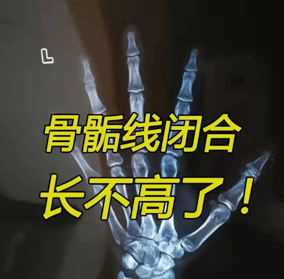 气到发抖，女儿定型身高154，昨天才知道真相。爸爸172，妈妈160，按照遗
