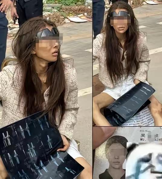 仔细看某桢的照片，我发现两个恐怖的细节。1、她的喉结特别大，就像男人的喉结