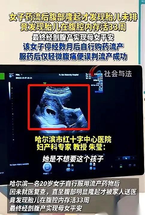 1月16日发布，哈尔滨一个20岁的姑娘，吃药想把孩子打掉。结果B超探头一