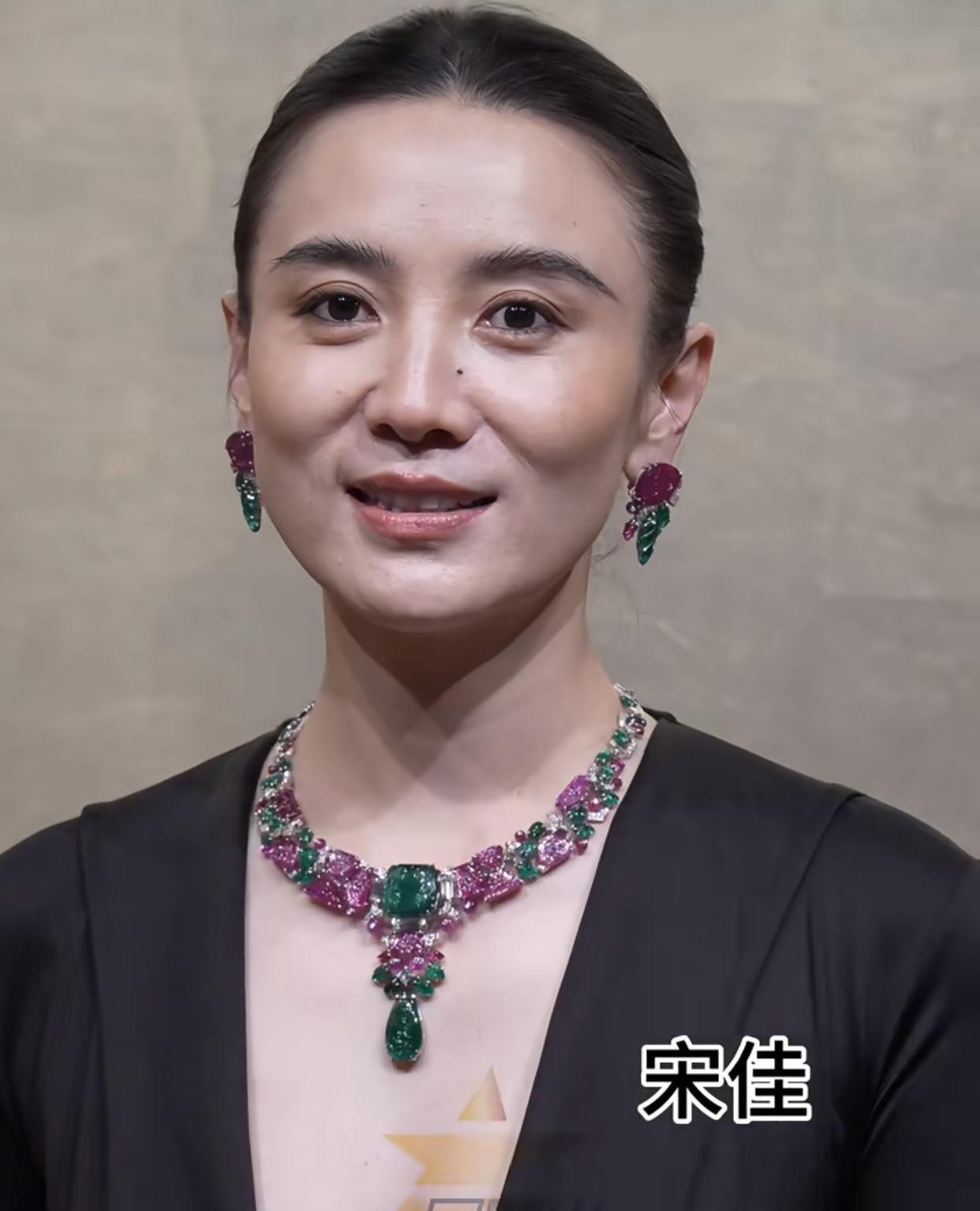 高清镜头下的宋佳，谁看了不竖起大拇指说一句真服气。她肯定没打针没医美吧，说