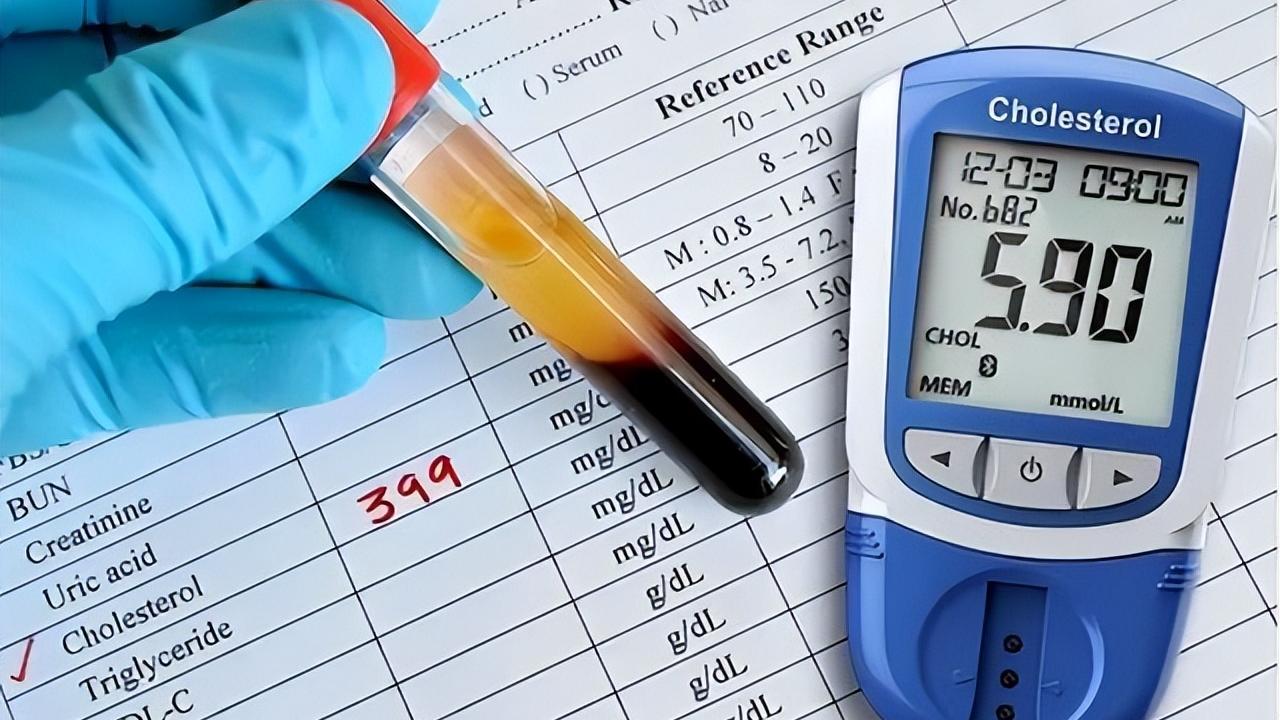 美国大学研究：高血脂是全身性疾病，不能只降脂，还要控制好这些一说到高血脂，很