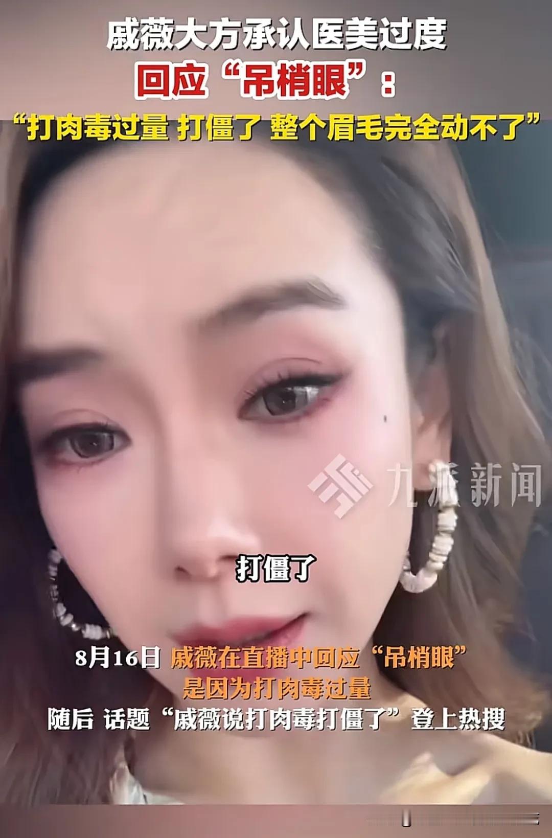 娱乐圈里有多少女艺人敢公开承认自己医美过度呢？除了戚薇，很难再有第二个了，她大方