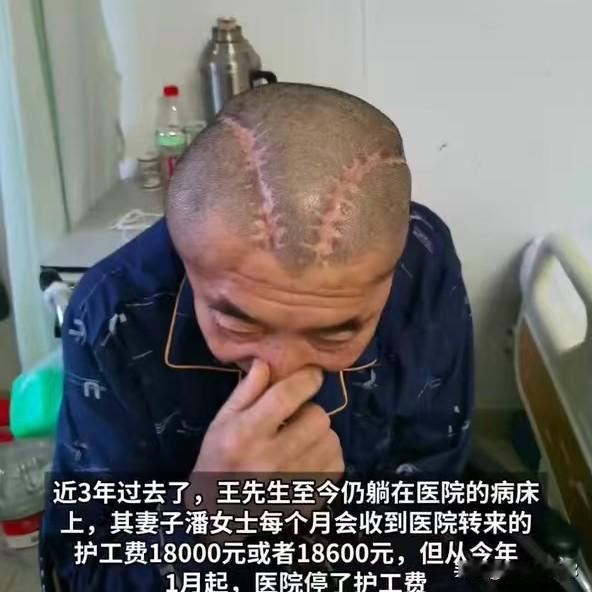这太炸裂了！做开颅手术，医院竟然把左右半脑都给搞反了。包头的王先生202
